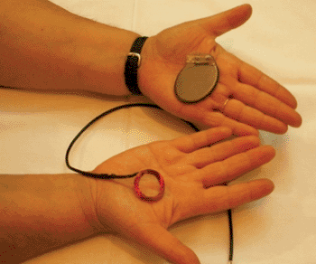 Image: The pacemaker device and an implantable coil prototype (Photo courtesy of António Abreu/ LNEG). Image: The pacemaker device and an implantable coil prototype (Photo courtesy of António Abreu/ LNEG).